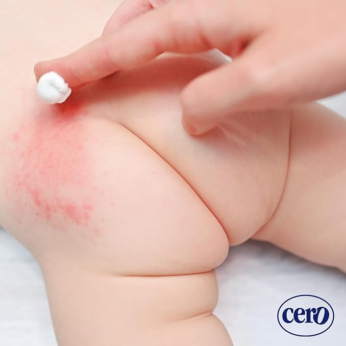 Diaper Rash Cream with Zinc Oxide for Babies – Crema Cero 8.5 oz | Fast Relief Ointment, Protective Barrier | Paraben-Free, Gentle for Newborns & Sensitive Skin