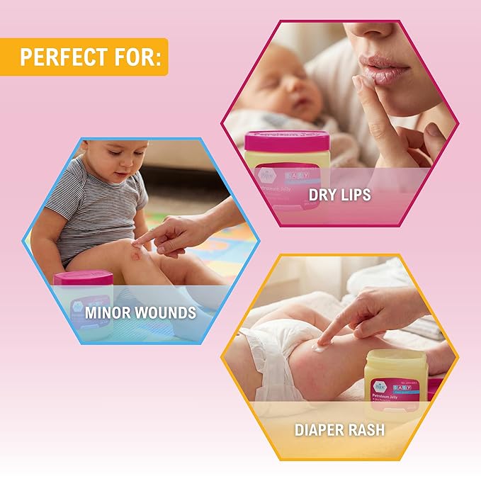 MED PRIDE Petroleum Jelly with Fresh Baby Scent, Pink, 13 oz – Skin Protectant & Moisturizing Ointment for Dry Skin, Rashes, Minor Burns, Chapped Lips & Diaper Rash