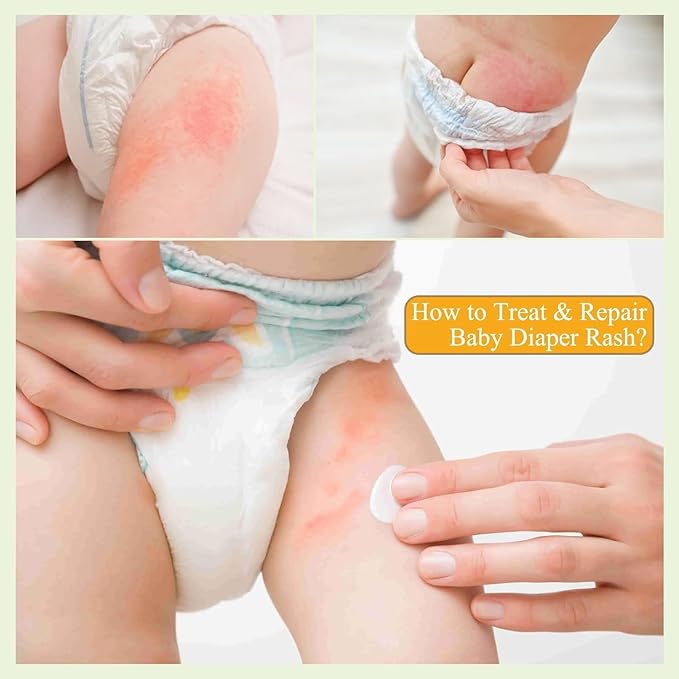 PEGO Diaper Rash Cream for Baby,Prevents, Soothes Diaper Rash,Essentials Zinc Oxide Ointment,Egg Yolk Oil, Gentle & Non-Irritating 100ml/3.38 Fl Oz