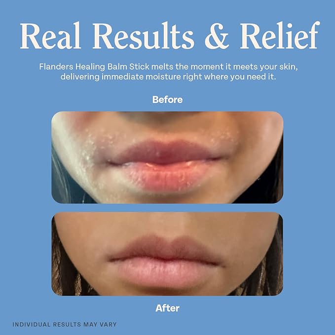 Flanders Skin Relief Bundle – 2 Tubes of Buttocks Ointment and 1 Stick of Healing Balm, Pharmacist Developed, Safe for Sensitive Skin, Made in USA