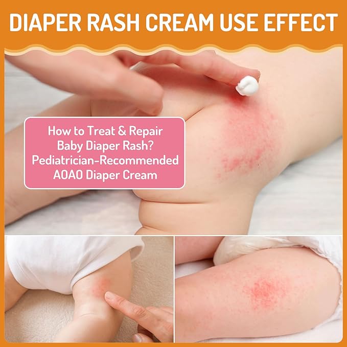 Baby Diaper Rash Cream with Zinc Oxide, Prevents & Heals Newborn Diaper Rash, Repairs Dry Cracked Skin, Gentle Toddler Butt Cream for Sensitive Skin, Instant Soothing Baby Skin Discomfort - 3.38oz