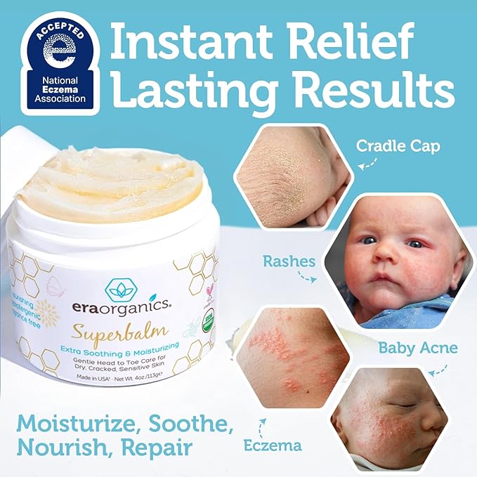 Era Organics Healing Ointment for Babies - USDA Certified Organic Natural Moisturizer Gentle on Sensitive Skin Prone To Baby Eczema, Cradle Cap (Infant Seborrheic Dermatitis), Rashes, Hives 4oz
