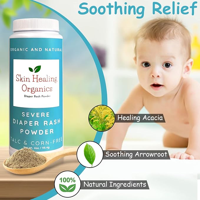 Severe Diaper Rash Treatment Powder - Heal & Cure Very Bad Horrible Diaper Rash Bleeding Blisters Quickly from Diarrhea for Newborn Infant & Adults - Skin Healing Organics