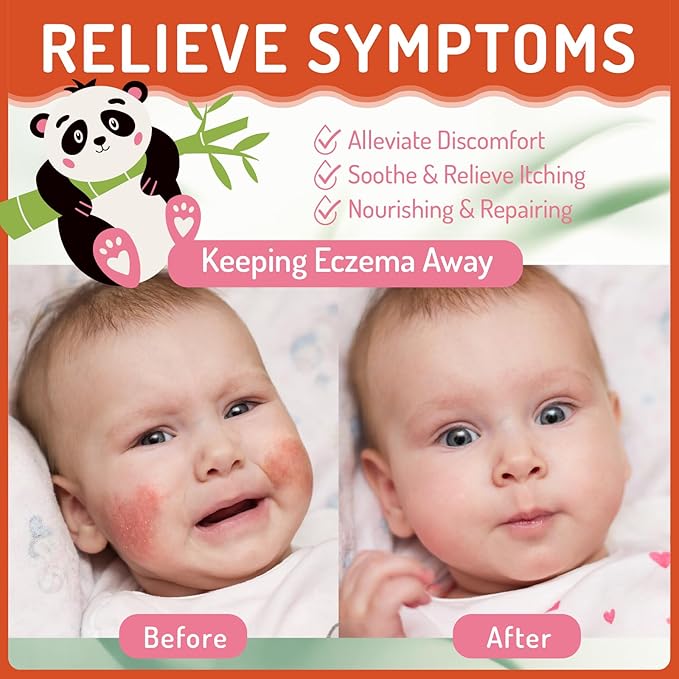 Baby Eczema Relief Cream, Eczema Treatment for Kids with Chrysanthemum, Multi-Purpose Baby Skin Relief Cream, Gentle On Sensitive Skin Prone To Baby Eczema, Hypoallergenic & Steroid-Free, 3.38oz