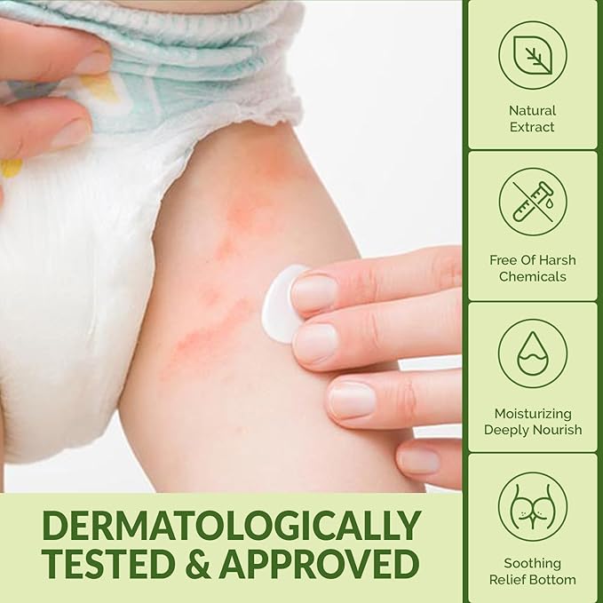 WBM Diaper Rash Cream | Baby Rash Relief Ointments Cream | Cruelty-Free, Hypoallergenic, Soothing, Moisturizing with Zinc Oxide | Gentle for Baby Skin | 2.82 oz