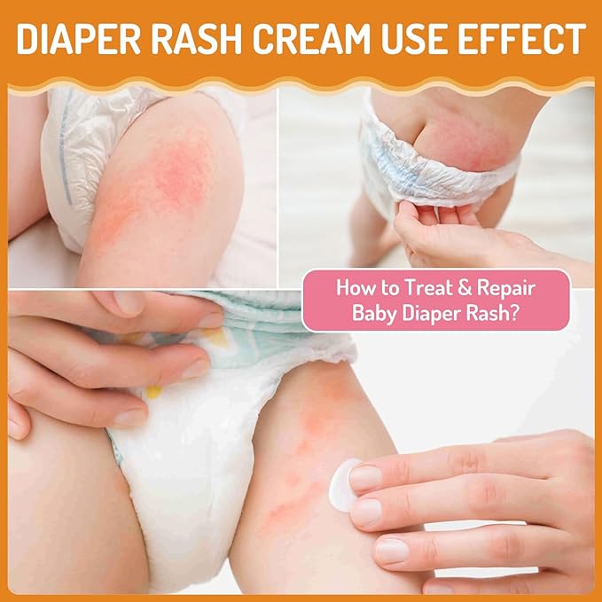 Baby Diaper Rash Cream with Zinc Oxide, Prevents & Heals Newborn Diaper Rash, Repairs Dry Cracked Skin, Gentle Toddler Butt Cream for Sensitive Skin, Instant Soothing Baby Skin Discomfort - 3.38oz