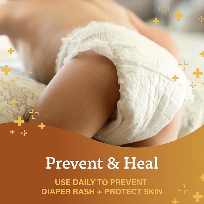 A+D Original Diaper Rash Ointment, Prevents & Heals Diaper Rash, Moisturizes & Heals Dry Skin With Vitamins A & D, Home & Go Bundle - 16 oz jar, 4 oz tube, 1.5 oz tube